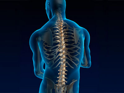 脊柱侧弯是腰椎间盘突出症状的表现之一